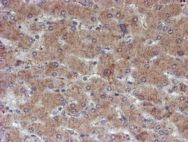 m03862 anti atrip mouse monoclonal antibody clone id oti5e7 ihc testing 11