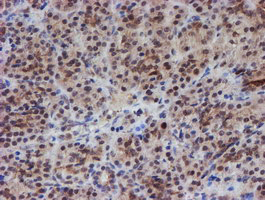 m03862 anti atrip mouse monoclonal antibody clone id oti5e7 ihc testing 4