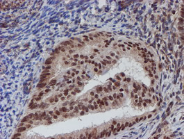 m03862 anti atrip mouse monoclonal antibody clone id oti5e7 ihc testing 5