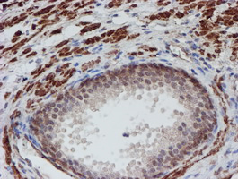 m03862 anti atrip mouse monoclonal antibody clone id oti5e7 ihc testing 6