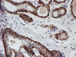 m03862 anti atrip mouse monoclonal antibody clone id oti5e7 ihc testing 7
