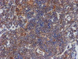 m03862 anti atrip mouse monoclonal antibody clone id oti5e7 ihc testing 8