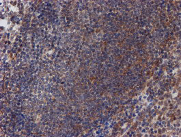 m03862 anti atrip mouse monoclonal antibody clone id oti5e7 ihc testing 9