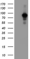 HEK293T cells were transfected with the pCMV6-ENTRY control (Left lane) or pCMV6-ENTRY ATRIP (Right lane) cDNA for 48 hrs and lysed