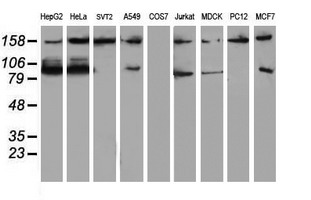 Western blot analysis of extracts (35ug) from 9 different cell lines by usin g anti-ATRIP monoclonal antibody (HepG2: human; HeLa: human; SVT2: mouse; A549: human; COS7: monkey; Jurkat: human; MDCK: canine; PC12: rat; MCF7: human)