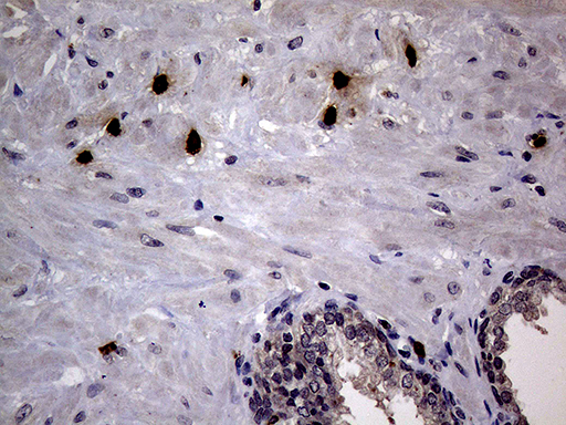 Immunohistochemical staining of paraffin-embedded Human prostate tissue within the normal limits using anti-PRTN3 mouse monoclonal antibody