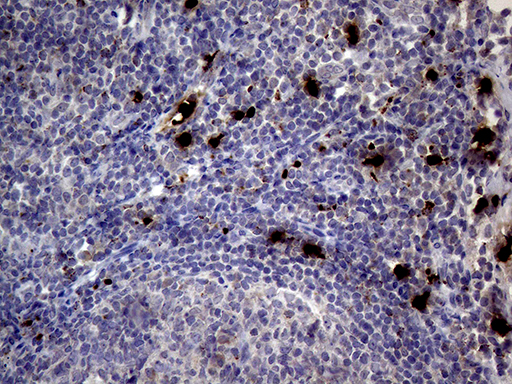 m03863 1 anti pr3 prtn3 mouse monoclonal antibody clone id oti9c2 ihc testing 4
