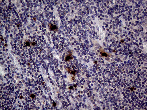 m03863 1 anti pr3 prtn3 mouse monoclonal antibody clone id oti9c2 ihc testing 6