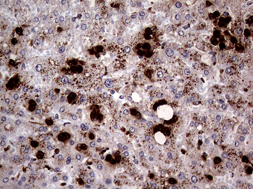 m03863 1 anti pr3 prtn3 mouse monoclonal antibody clone id oti9c2 ihc testing 7