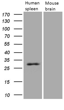 Western blot analysis of extracts (15ug) from human spleen tissue lysate and mouse brain tissue lysate by using anti-PRTN3 monoclonal antibody (1:500)
