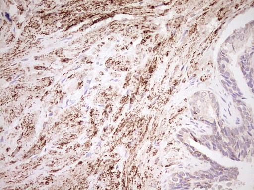 m03866 anti nr0b2 mouse monoclonal antibody clone id oti7b5 ihc testing 10