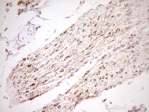 m03866 anti nr0b2 mouse monoclonal antibody clone id oti7b5 ihc testing 11