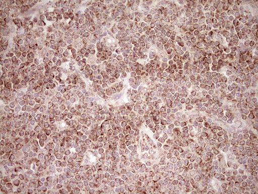 m03866 anti nr0b2 mouse monoclonal antibody clone id oti7b5 ihc testing 13
