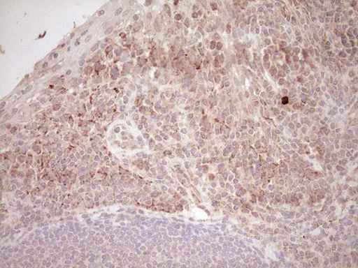 m03866 anti nr0b2 mouse monoclonal antibody clone id oti7b5 ihc testing 14