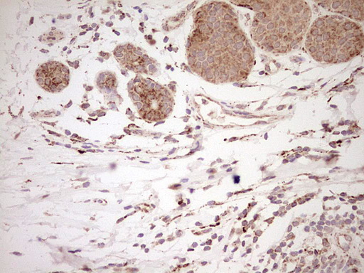 m03866 anti nr0b2 mouse monoclonal antibody clone id oti7b5 ihc testing 15