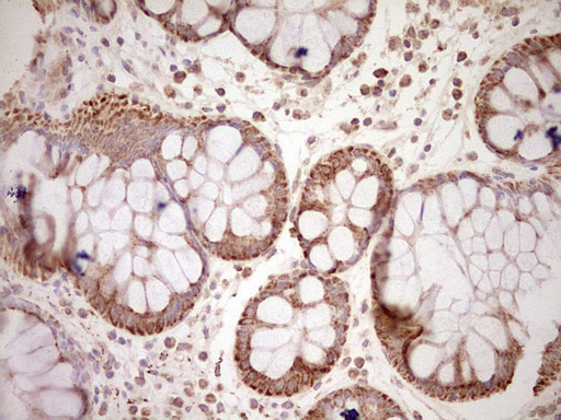 m03866 anti nr0b2 mouse monoclonal antibody clone id oti7b5 ihc testing 16