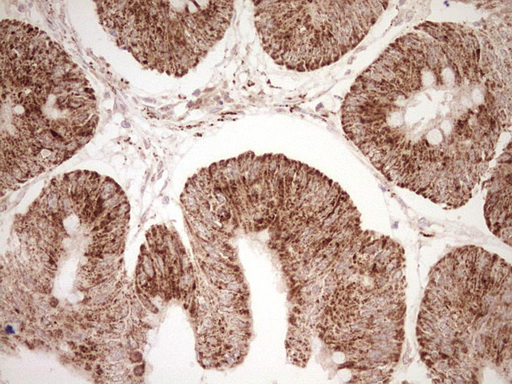 m03866 anti nr0b2 mouse monoclonal antibody clone id oti7b5 ihc testing 17