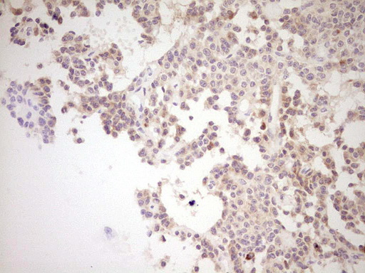 m03866 anti nr0b2 mouse monoclonal antibody clone id oti7b5 ihc testing 2