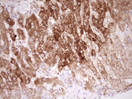 m03866 anti nr0b2 mouse monoclonal antibody clone id oti7b5 ihc testing 20