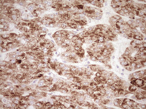 m03866 anti nr0b2 mouse monoclonal antibody clone id oti7b5 ihc testing 21