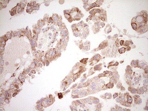 m03866 anti nr0b2 mouse monoclonal antibody clone id oti7b5 ihc testing 3