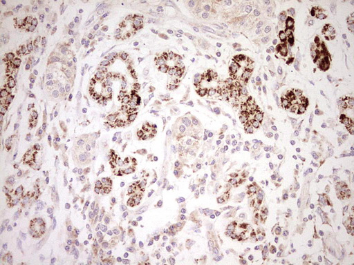 m03866 anti nr0b2 mouse monoclonal antibody clone id oti7b5 ihc testing 5