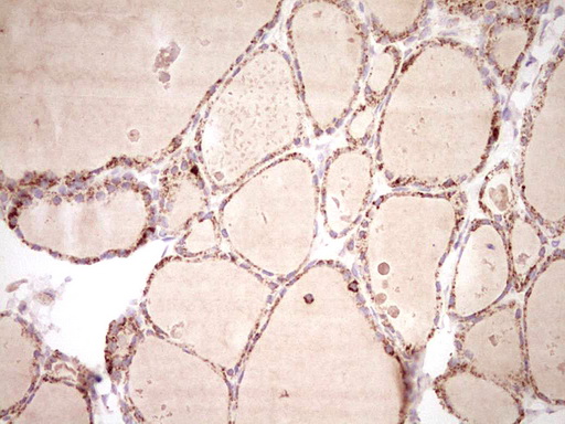 m03866 anti nr0b2 mouse monoclonal antibody clone id oti7b5 ihc testing 6