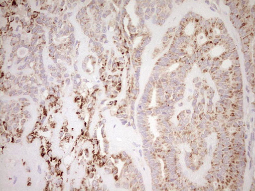 m03866 anti nr0b2 mouse monoclonal antibody clone id oti7b5 ihc testing 7