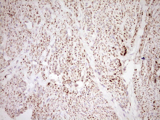 m03866 anti nr0b2 mouse monoclonal antibody clone id oti7b5 ihc testing 9