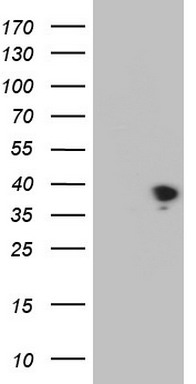 HEK293T cells were transfected with the pCMV6-ENTRY control (Left lane) or pCMV6-ENTRY THTPA (Right lane) cDNA for 48 hrs and lysed