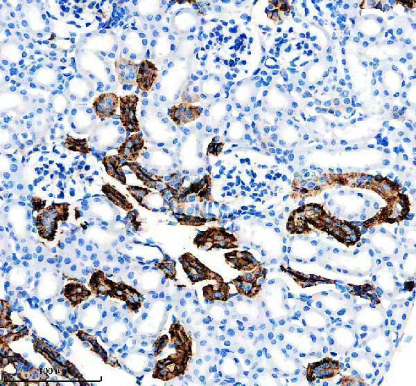 IHC analysis of NCX1 using anti-NCX1 antibody (M03876)