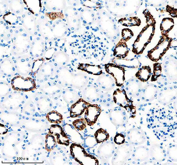 IHC analysis of NCX1 using anti-NCX1 antibody (M03876)