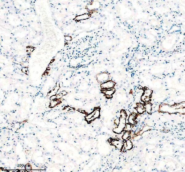 m03876 ncx1 primary antibodies ihc testing 3