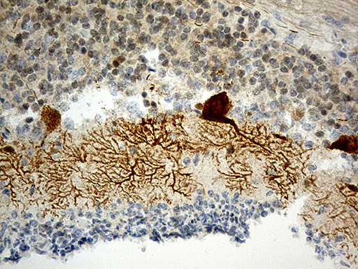 m03877 anti homer1 mouse monoclonal antibody clone id oti7g10 ihc testing 3