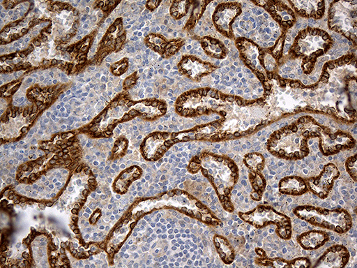 m03877 anti homer1 mouse monoclonal antibody clone id oti7g10 ihc testing 4
