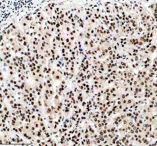 m03878 nsun2 primary antibodies ihc testing 1