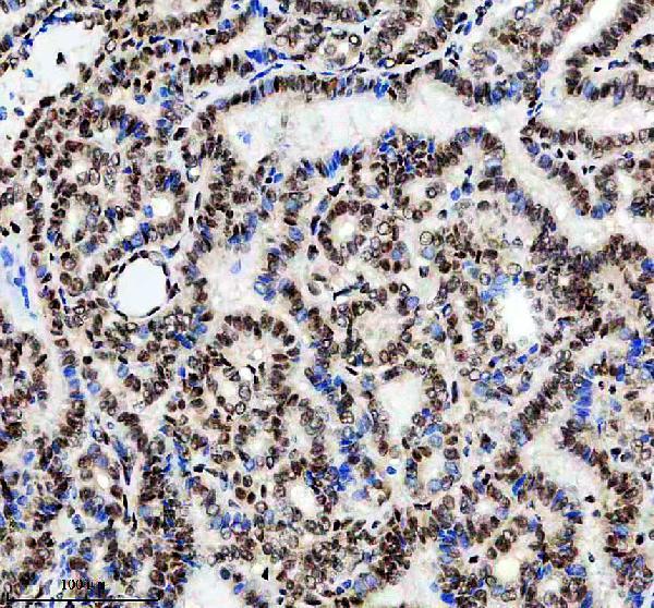 m03878 nsun2 primary antibodies ihc testing 2