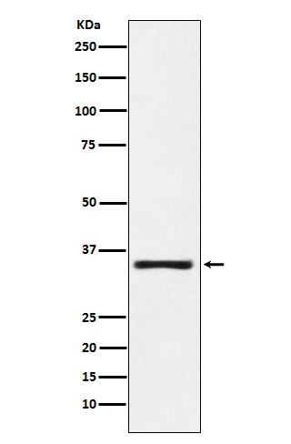 Western blot analysis of KLK2 expression in MOLT4 cell lysate