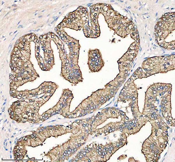 m03879 klk2 primary antibodies ihc testing 1