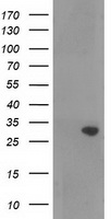 HEK293T cells were transfected with the pCMV6-ENTRY control (Left lane) or pCMV6-ENTRY RASSF5 (Right lane) cDNA for 48 hrs and lysed