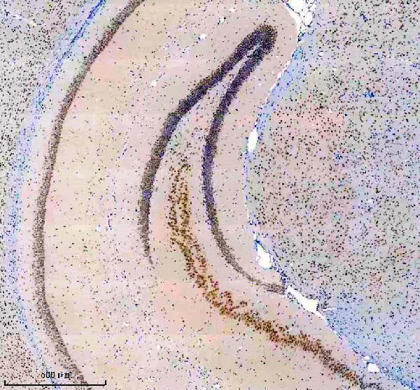 m03887 1 usp22 primary antibodies ihc testing 1