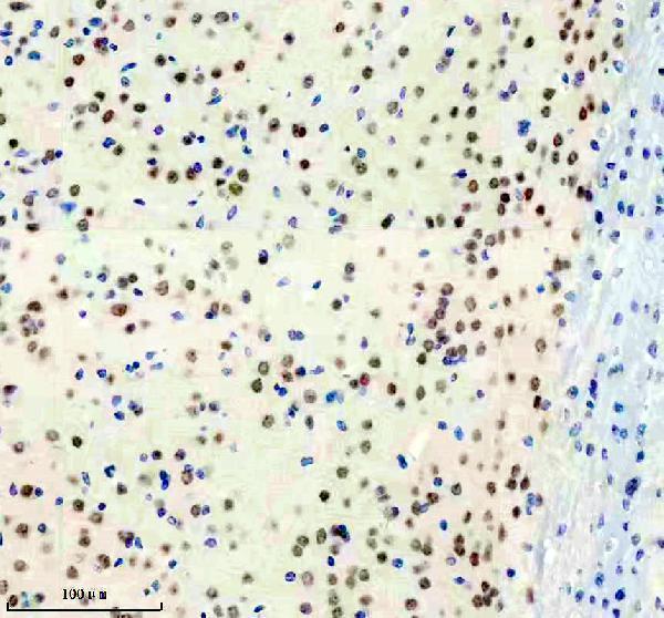 m03887 1 usp22 primary antibodies ihc testing 2