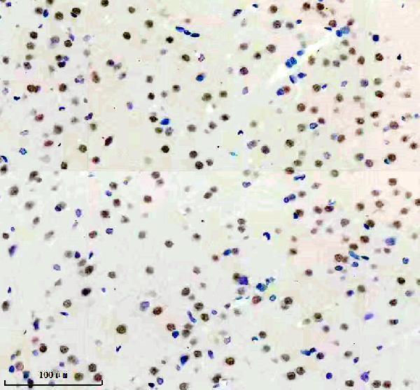 m03887 1 usp22 primary antibodies ihc testing 3