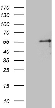 HEK293T cells were transfected with the pCMV6-ENTRY control (Left lane) or pCMV6-ENTRY PTF1A (Right lane) cDNA for 48 hrs and lysed