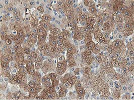 m03893 1 anti aldob mouse monoclonal antibody clone id oti3c6 ihc testing 3