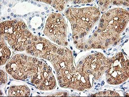 m03893 anti aldob mouse monoclonal antibody clone id oti3e10 ihc testing 2