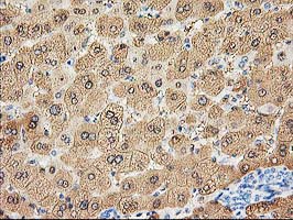m03893 anti aldob mouse monoclonal antibody clone id oti3e10 ihc testing 3