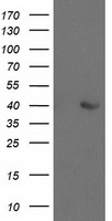 m03893 anti aldob mouse monoclonal antibody clone id oti3e10 wb testing 1