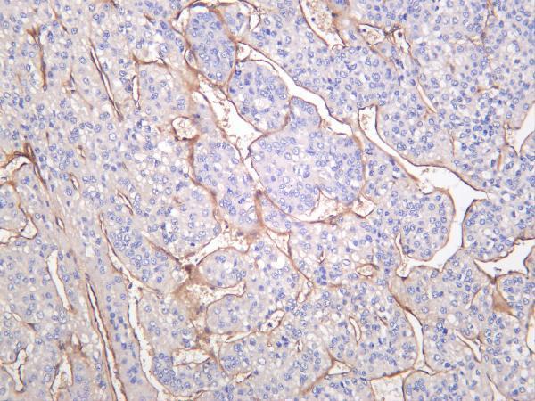 m03894 2 lamb1 primary antibodies ihc testing 1