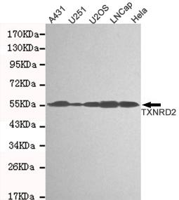 Western blot detection of TXNRD2 in A431, U251, U2OS, LNCAP&Hela cell lysates and using TXNRD2 antibody (1:1000 diluted) 